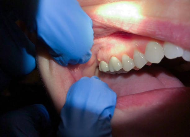 Best Pediatric Emergency Dentist in Elgin, OK
